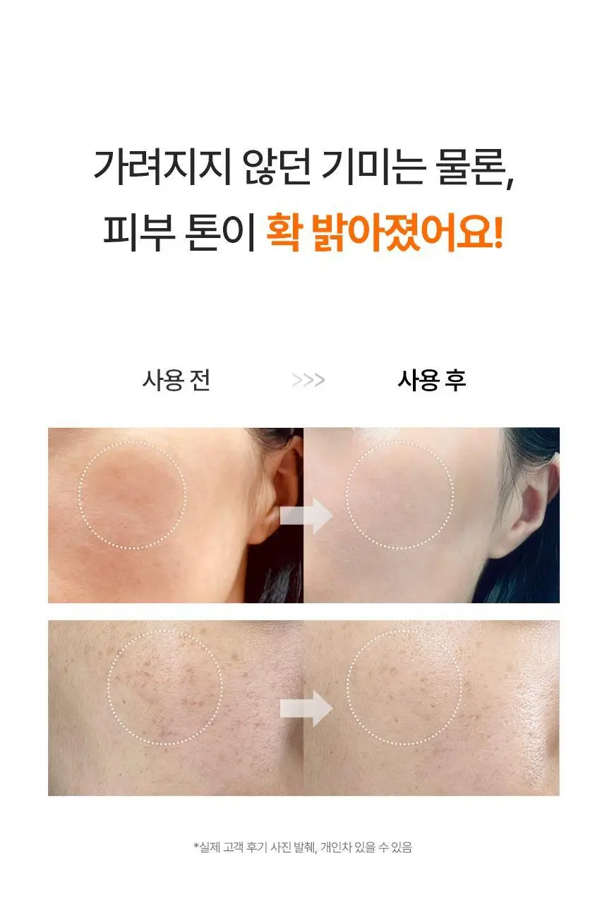 [비타민4천샷/고중량] 아로셀 멜라 TXA 마스크 1매 43g 상세페이지 4